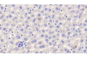 Detection of HPX in Rat Liver Tissue using Polyclonal Antibody to Hemopexin (HPX) (Hemopexin Antikörper  (AA 31-242))