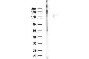 Western blot analysis of lysates from PC12 cells(UV,30 min treatment), using PMS1 Antibody at 1/1000 dilution.