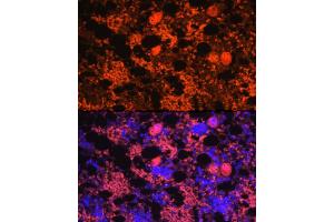 Immunofluorescence analysis of rat bone marrow using CXCL4/PF4 Rabbit pAb (ABIN7269400) at dilution of 1:100 (40x lens). (PF4 Antikörper)