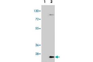Western blot analysis of UBE2H (arrow) using UBE2H polyclonal antibody . (UBE2H Antikörper  (C-Term))