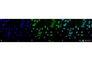 Immunocytochemistry/Immunofluorescence analysis using Rabbit Anti-Acetylated Lysine Polyclonal Antibody . (Lysine (lys) (acetylated) Antikörper (PerCP))