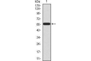 Western blot analysis using HOXA9 mAb against human HOXA9 (AA: 1-272) recombinant protein. (HOXA9 Antikörper  (AA 1-272))