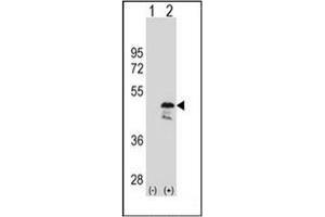 Western blot analysis of OLA1 (arrow) using GTPBP9 / OLA1 Antibody (N-term) Cat. (OLA1 Antikörper  (N-Term))