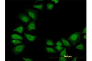 Immunofluorescence of monoclonal antibody to TXN on HeLa cell. (TXN Antikörper  (AA 1-105))