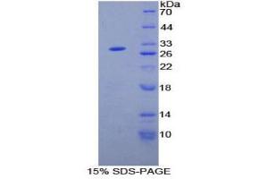 SDS-PAGE (SDS) image for Angiopoietin-Like 2 (ANGPTL2) (AA 267-493) protein (His tag) (ABIN1078798)