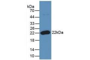 Detection of Recombinant RANkL, Human using Monoclonal Antibody to Receptor Activator Of Nuclear Factor Kappa B Ligand (RANkL) (RANKL Antikörper  (AA 79-247))