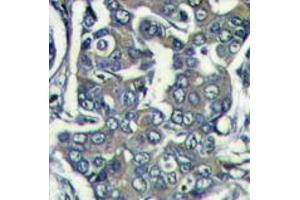 Image no. 1 for anti-Eukaryotic Translation Initiation Factor 4E Family Member 2 (EIF4E2) (N-Term) antibody (ABIN357298) (EIF4E2 Antikörper  (N-Term))