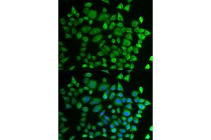 Immunofluorescence analysis of HeLa cells using P4HTM antibody (ABIN6292983). (P4HTM Antikörper)