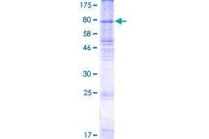 Image no. 1 for Rh Family C Glycoprotein (RHCG) (AA 1-479) protein (GST tag) (ABIN1317995) (RHCG Protein (AA 1-479) (GST tag))