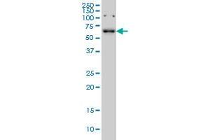 CCDC6 monoclonal antibody (M03), clone 5D11 Western Blot analysis of CCDC6 expression in K-562 . (CCDC6 Antikörper  (AA 375-474))