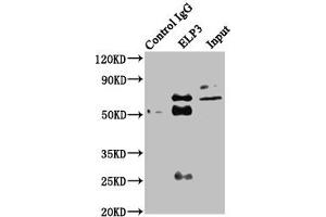 Immunoprecipitating ELP3 in HEK293 whole cell lysate Lane 1: Rabbit control IgG instead of ABIN7151580 in HEK293 whole cell lysate. (ELP3/KAT9 Antikörper  (AA 1-85))