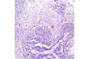 IHC analysis of TANK using anti-TANK antibody (ABIN6719508). (TANK Antikörper)