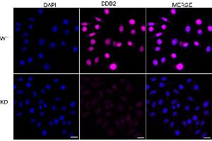 Immunocytochemical staining of HeLa cells using DDB2 antibody (ABIN7798274), 1:1,000), Top panel: wild-type (WT), Bottom panal: DDB2 shRNA knockdown (KD). (Rekombinanter DDB2 Antikörper)