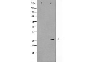 Western blot analysis on HuvEc cell lysate using SIX6 Antibody，The lane on the left is treated with the antigen-specific peptide. (SIX Homeobox 6 Antikörper  (Internal Region))