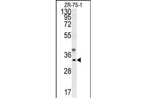 GCH1 Antibody (N-term) (ABIN652021 and ABIN2840501) western blot analysis in ZR-75-1 cell line lysates (35 μg/lane). (GCH1 Antikörper  (N-Term))