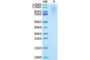 Human CD43 on Tris-Bis PAGE under reduced condition. (CD43 Protein (AA 20-253) (His tag))