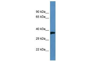 Western Blotting (WB) image for anti-Opsin 1 (Cone Pigments), Medium-Wave-Sensitive (OPN1MW) (C-Term) antibody (ABIN2788201)