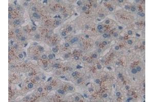 Detection of CD301 in Human Liver Tissue using Polyclonal Antibody to Cluster Of differentiation 301 (CD301) (CLEC10A Antikörper  (AA 71-239))