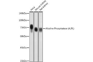 Western blot analysis of extracts of various cell lines, using Alkaline Phosphatase (ALPL) antibody (ABIN3021385, ABIN3021386, ABIN1512569 and ABIN6214987) at 1:1000 dilution. (ALPL Antikörper  (AA 20-270))