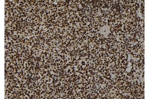 ABIN6254985 and ABIN6267200 at 1/100 staining Mouse spleen tissue by IHC-P.