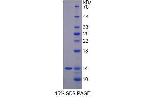 Image no. 1 for S100 Calcium Binding Protein A12 (S100A12) (AA 2-92) protein (His tag) (ABIN6238579) (S100A12 Protein (AA 2-92) (His tag))