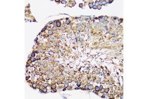 Immunohistochemistry (Paraffin-embedded Sections) (IHC (p)) image for anti-Interleukin-1 Receptor-Associated Kinase 4 (IRAK4) (AA 1-220) antibody (ABIN6142522)