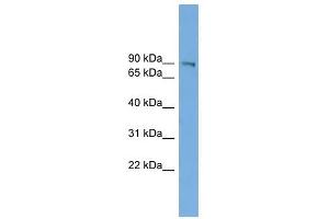 UTP14A antibody used at 1 ug/ml to detect target protein.