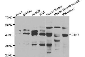 Western blot analysis of extracts of various cell lines, using CTNS antibody.