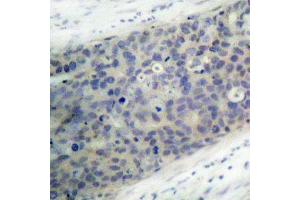 Immunohistochemistry (IHC) image for anti-LIM Domain Kinase 2 (LIMK2) (pThr505) antibody (ABIN3020313) (LIMK2 Antikörper  (pThr505))