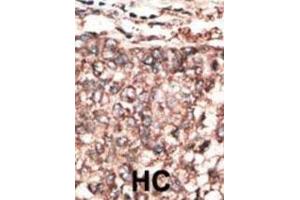 Immunohistochemistry (IHC) image for anti-Platelet Derived Growth Factor D (PDGFD) antibody (ABIN3002574)