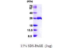 SDS-PAGE (SDS) image for MOB1, Mps One Binder Kinase Activator-Like 1B (MOBKL1B) (AA 1-216) protein (His tag) (ABIN667320)