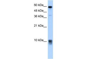 WB Suggested Anti-S100A3 Antibody Titration:  5. (S100A3 Antikörper  (N-Term))