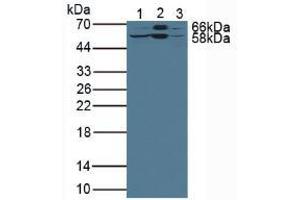 Western blot analysis of (1) Rat Liver Tissue, (2) Mouse Liver Tissue and (3) Human HepG2 Cells. (LSR Antikörper  (AA 35-205))