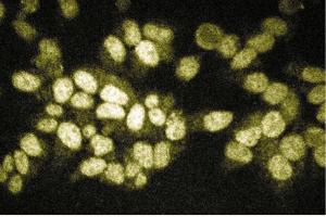 Immunofluorescent staining of HeLa cells. (RIPK2 Antikörper  (AA 333-532))