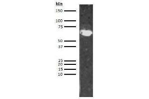 Western Blotting (WB) image for anti-Low Molecular Weight Kininogen (LMWK) antibody (Biotin) (ABIN613239) (LMW Kininogen Antikörper  (Biotin))