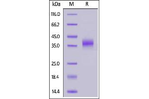 Biotinylated Cynomolgus NKp46, His,Avitag on  under reducing (R) condition.
