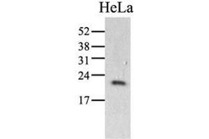 The HeLa (40ug) were resolved by SDS-PAGE, transferred to PVDF membrane and probed with anti-human PPIC antibody (1:1000).