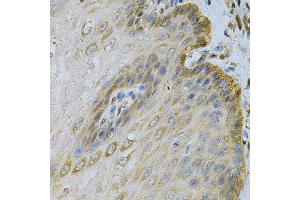 Immunohistochemistry (Paraffin-embedded Sections) (IHC (p)) image for anti-Phosphoglycerate Kinase 1 (PGK1) (AA 1-417) antibody (ABIN6145504)