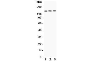 Western blot testing of Angiotensin Converting Enzyme antibody and Lane 1:  A549;  2: HeLa;  3: 22RV1 lysate. (Angiotensin I Converting Enzyme 1 Antikörper  (N-Term))
