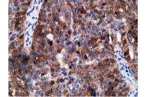 Immunohistochemical staining of paraffin-embedded Human colon tissue using anti-EPHX2 mouse monoclonal antibody. (EPHX2 Antikörper)