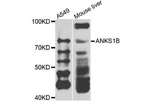 Western blot analysis of extracts of A549 and mouse liver cells, using ANKS1B antibody. (ANKS1B Antikörper)