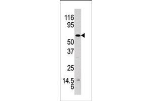Image no. 1 for anti-V-Akt Murine Thymoma Viral Oncogene Homolog 1 (AKT1) (pTyr326) antibody (ABIN358077) (AKT1 Antikörper  (pTyr326))