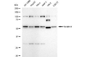 Western blotting analysis using Keratin 4 antibody (ABIN7799178).