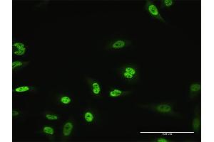 Immunofluorescence of monoclonal antibody to MZF1 on HeLa cell.