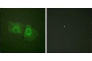Immunofluorescence analysis of HeLa cells, using Keratin 18 (Ab-33) Antibody. (Cytokeratin 18 Antikörper  (AA 1-50))