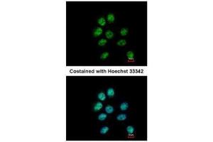 ICC/IF Image Immunofluorescence analysis of paraformaldehyde-fixed A431, using ZNF143, antibody at 1:500 dilution. (ZNF143 Antikörper  (C-Term))
