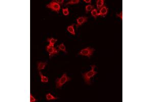 ABIN6268813 staining HuvEC by IF/ICC. (CD70 Antikörper  (Internal Region))