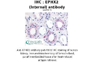 Image no. 1 for anti-Epoxide Hydrolase 2, Cytoplasmic (EPHX2) (Internal Region) antibody (ABIN1734089) (EPHX2 Antikörper  (Internal Region))