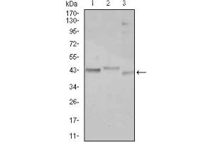 Western blot analysis using CEBPA antibody against Jurkat (1), k562 (2), and HepG2 (3) cell lysate.