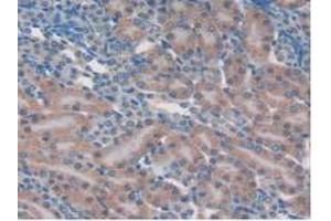 Immunohistochemistry (IHC) image for anti-Mitogen-Activated Protein Kinase 7 (MAPK7) (AA 185-419) antibody (ABIN7442186)